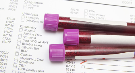 blood vials